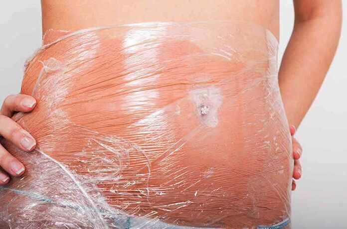 Wrapping with adhesive film promotes fat burning in the problem area